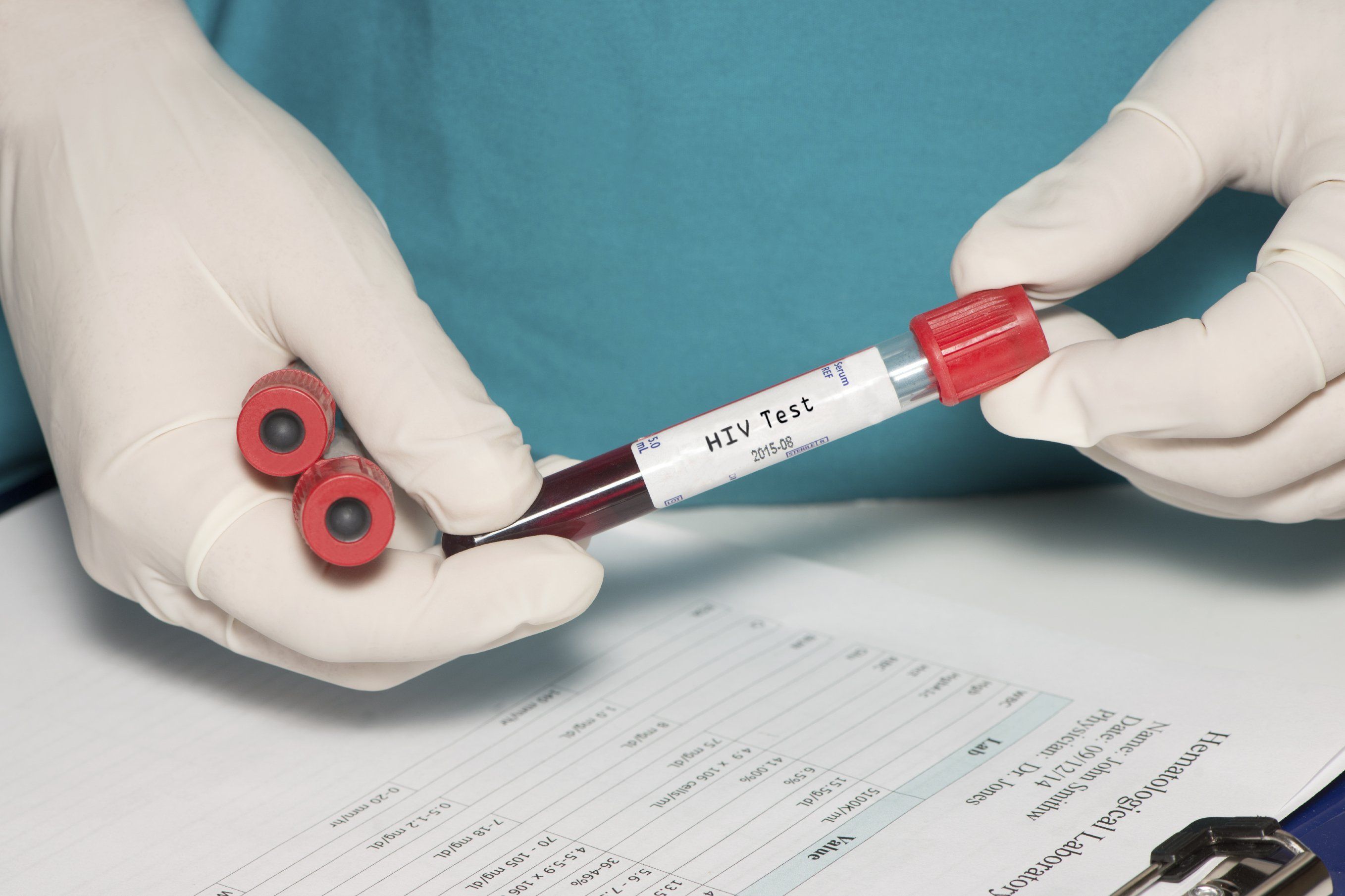 Hiv scare in porn